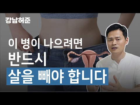 이 질환은 마를 정도로 살을 빼라고 권유합니다. 다낭성난소증후군은 진짜 건강하게 빼야 치료가 잘 됩니다.
